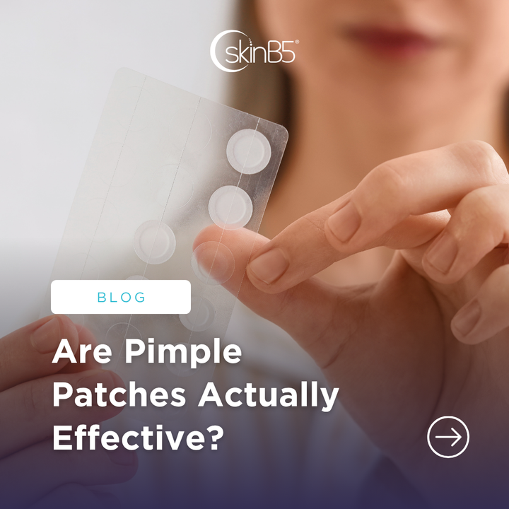 Are Pimple Patches Actually Effective?